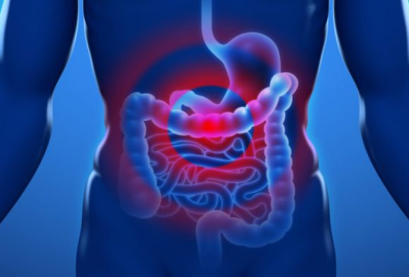 I 6 sintomi che ci devono mettere in allarme per gravi problemi al colon