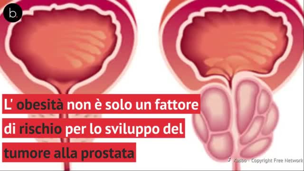 unanalisi delle urine può rilevare la prostatite