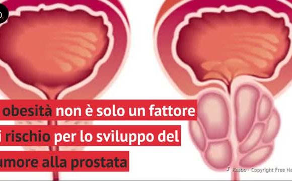tumore prostata pensione invalidita