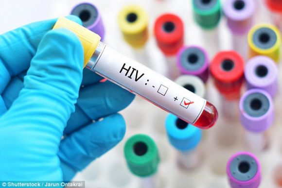 Epidemia HIV: appello in Europa, situazione preoccupante