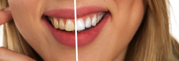 Come avere i denti bianchi in base a quello che mangiamo